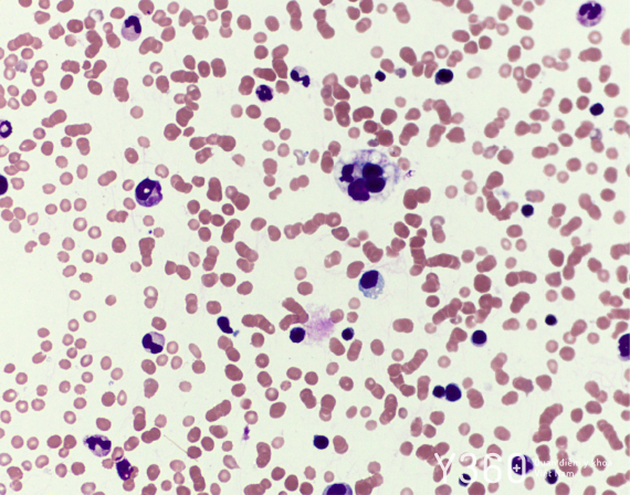 SỐT KÉO DÀI image