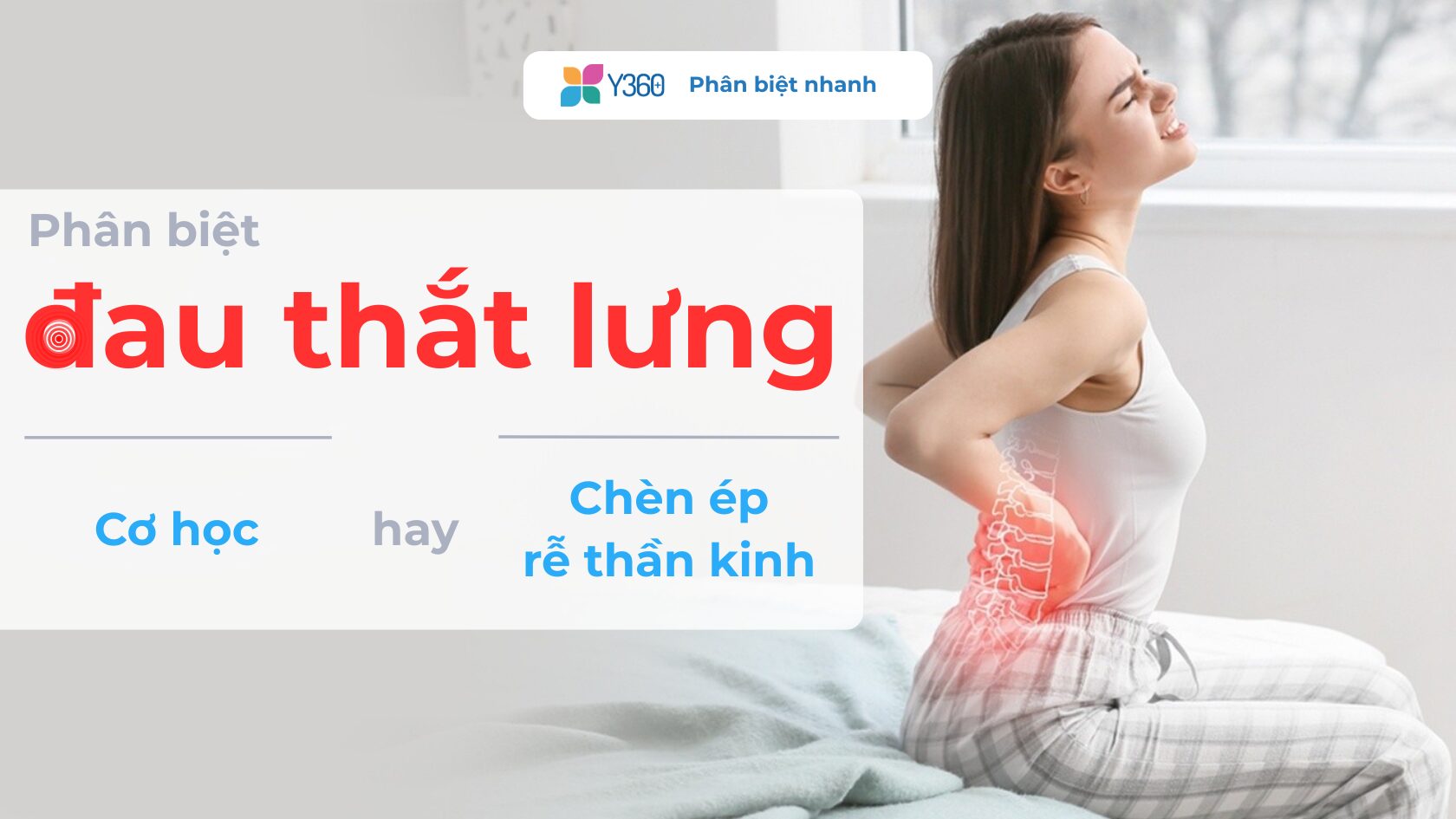 Phân biệt đau thắt lưng cơ học và đau gợi ý chèn ép rễ thần kinh