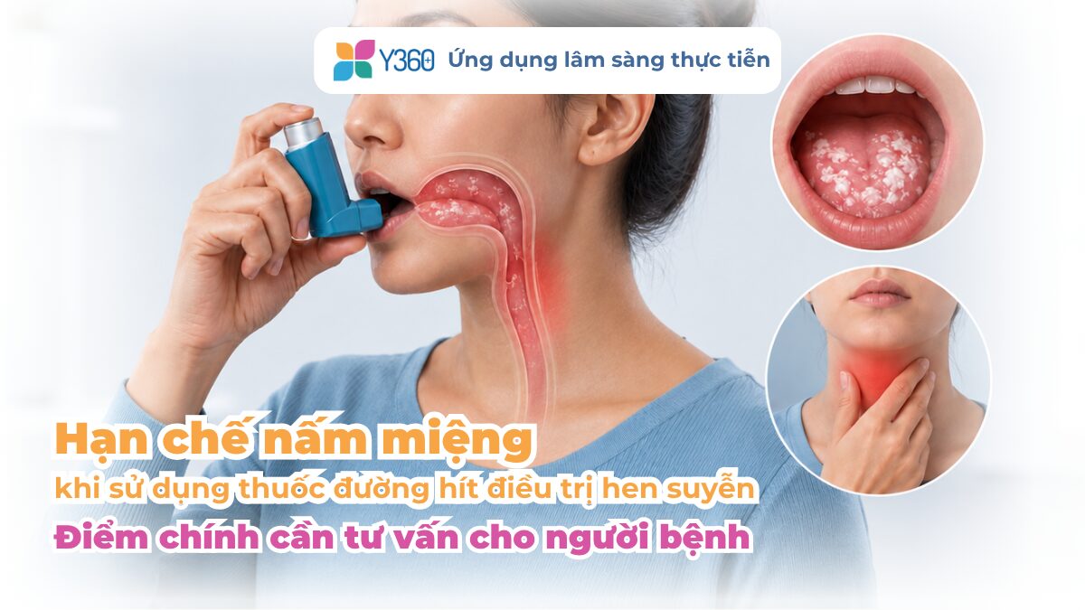 Hạn chế nấm miệng khi sử dụng thuốc đường hít điều trị hen suyễn: Điểm chính cần tư vấn cho người bệnh